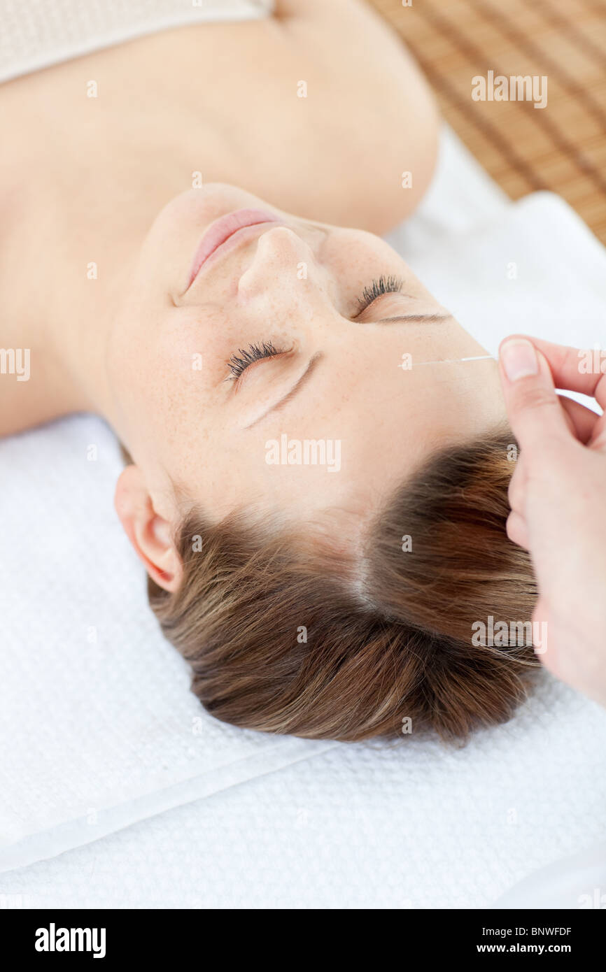 Acupuncture needles on a woman's head Stock Photo