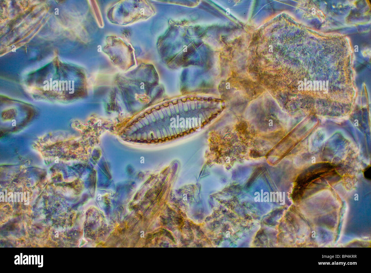 Darkfield / phase contrast photomicrograph, diatom, Surirella spp, Dinnington ponds waterfall Stock Photo