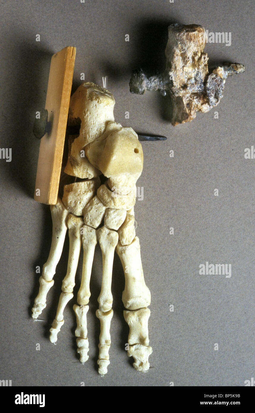 Roman Crucifixion Nails