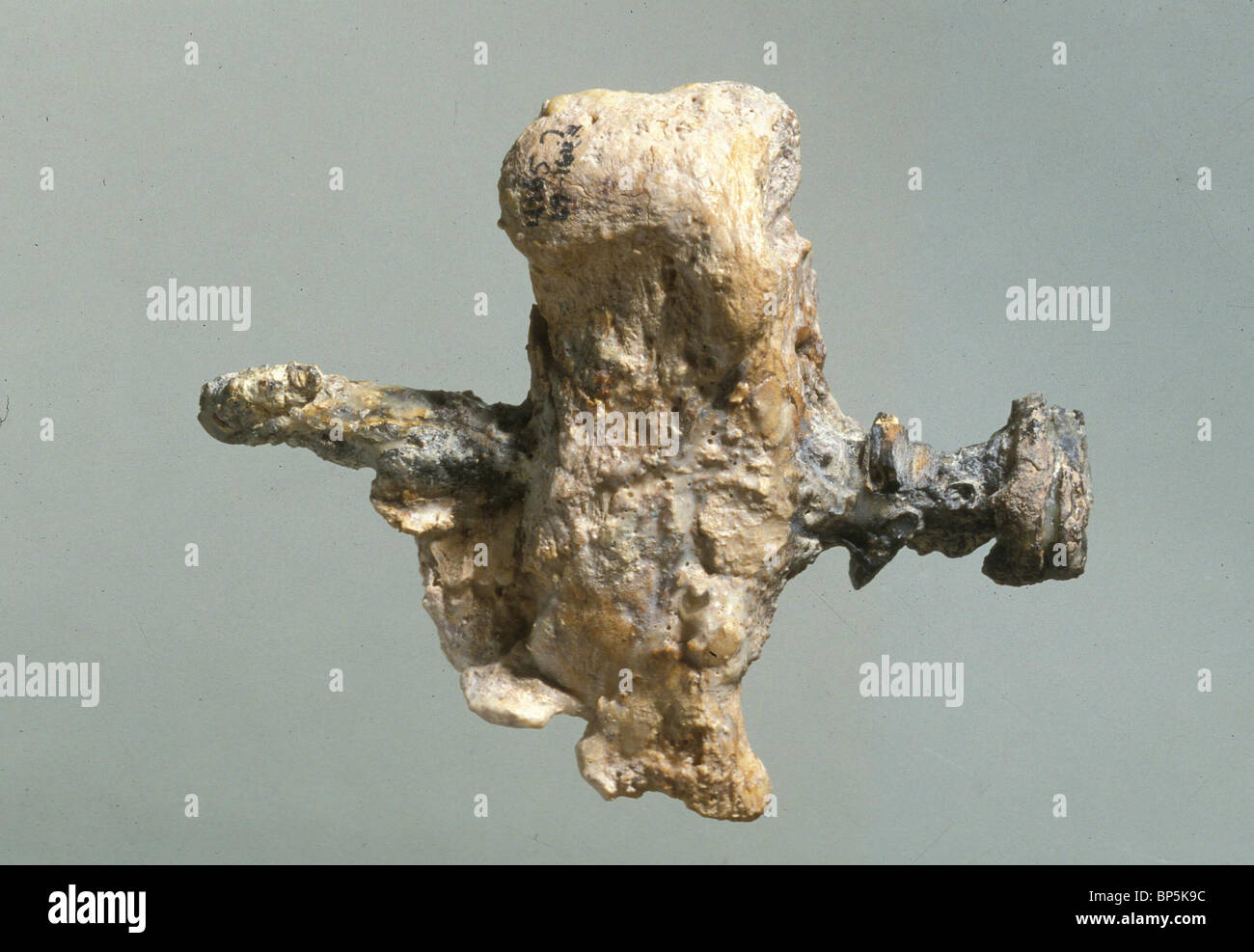 HEELBONE OF A CRUCIFIED MAN WITH THE IRON NAIL THAT PIERCED THE BONE & FASTENED HIM TO THE WOOD. THE BONE WAS FOUND IN AN Stock Photo
