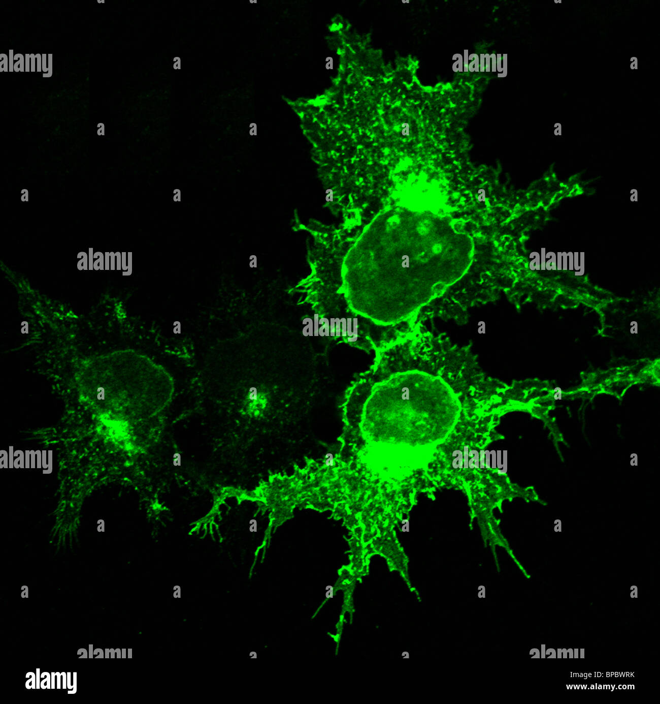 Immunofluorescent image of KIAA0319 protein in cells Stock Photo