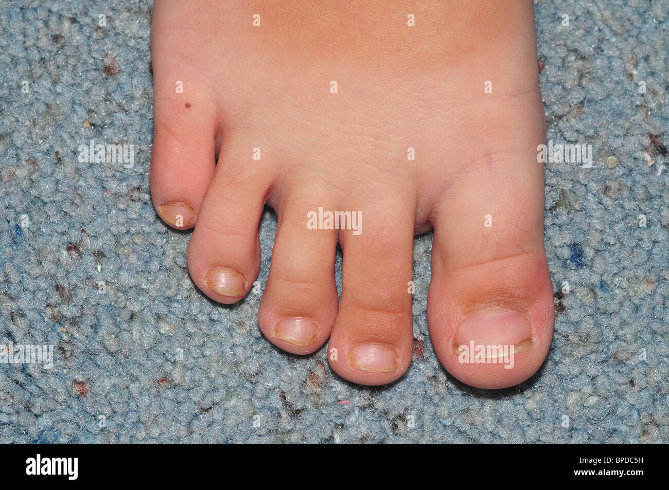 Healthy Toes Photos and Images