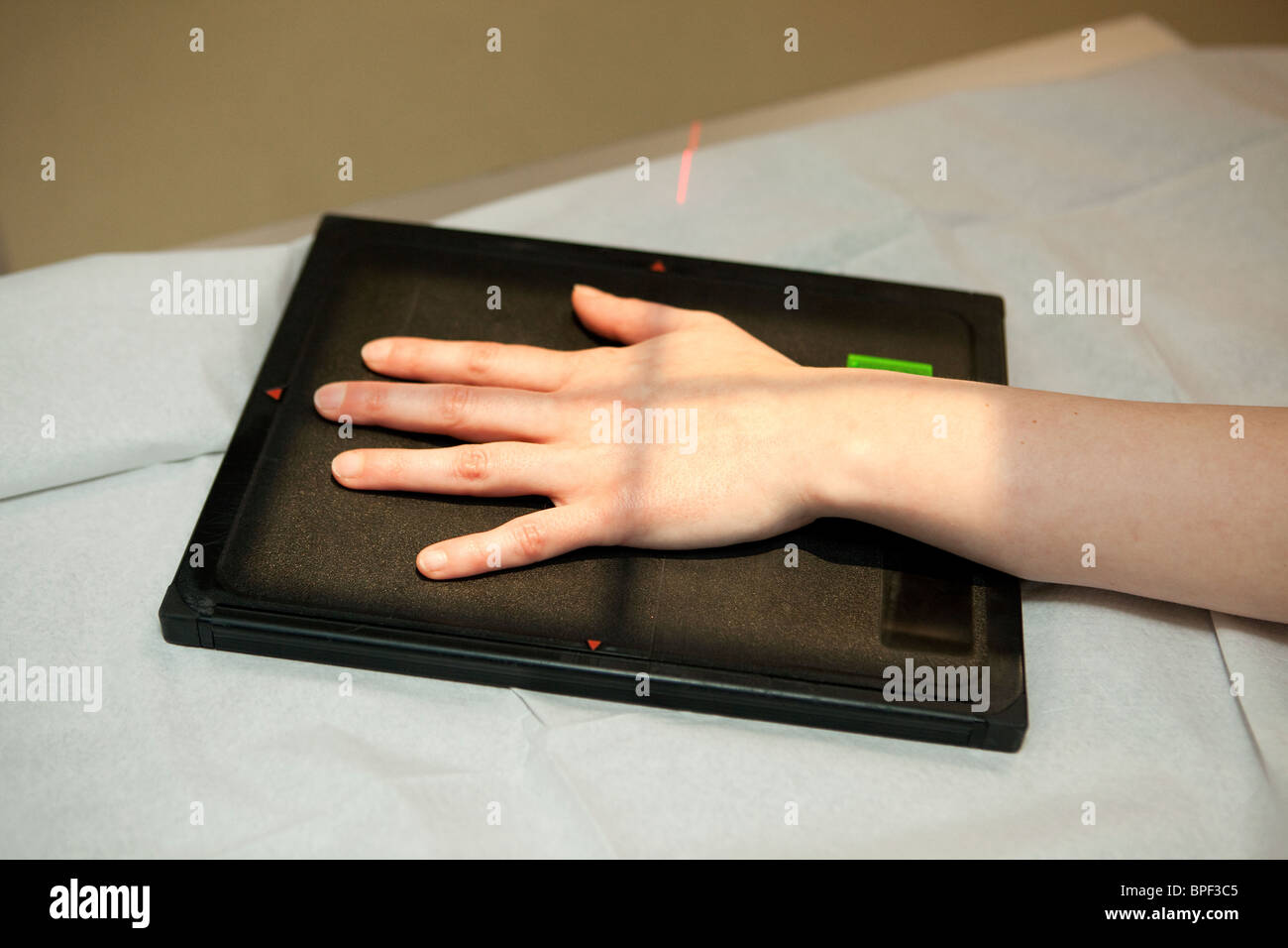 a hand is x-rayed Stock Photo