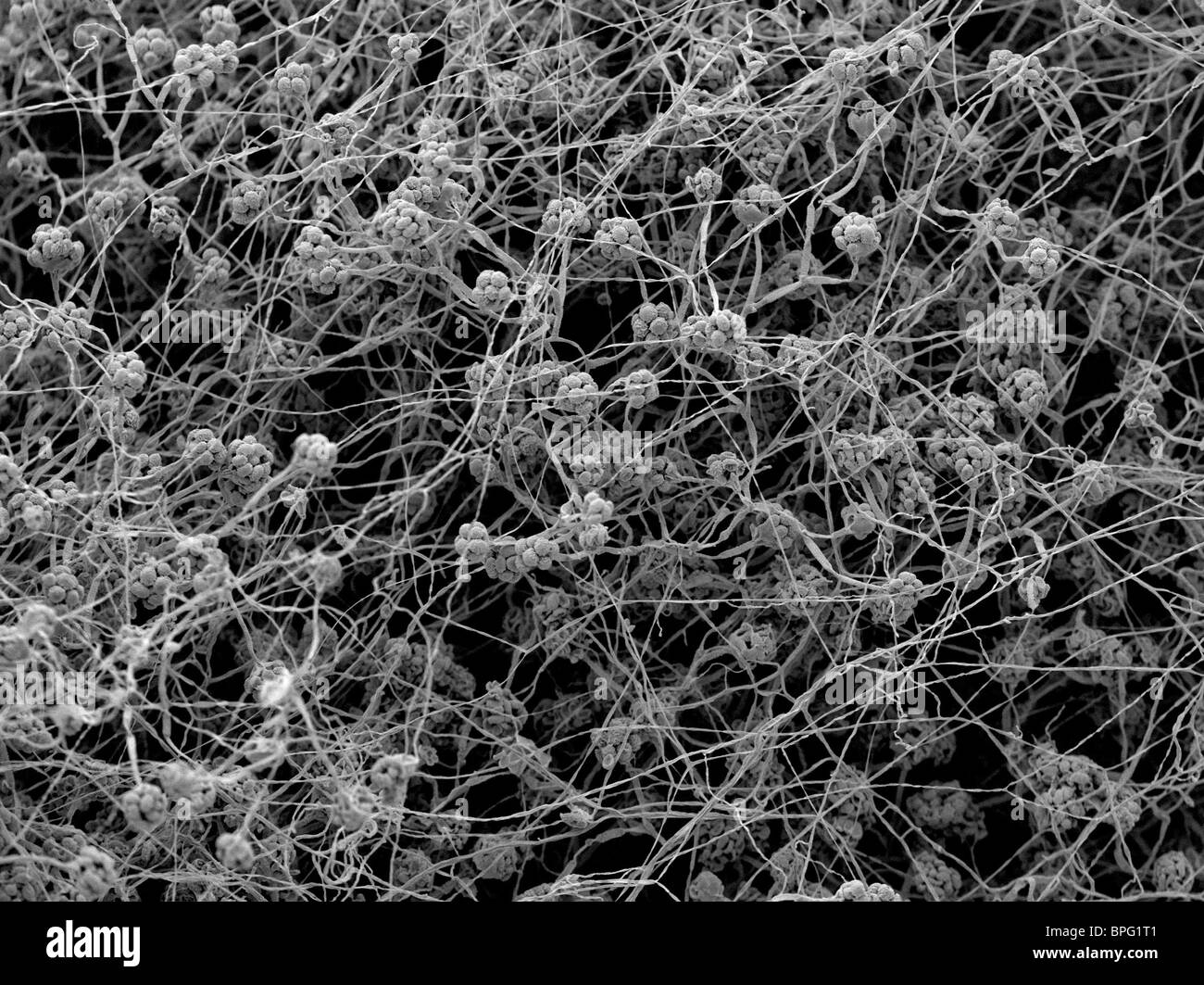A scanning electron micrograph (SEM) of Stachybotrys chartarum, a greenish black cellulotytic fungus Stock Photo