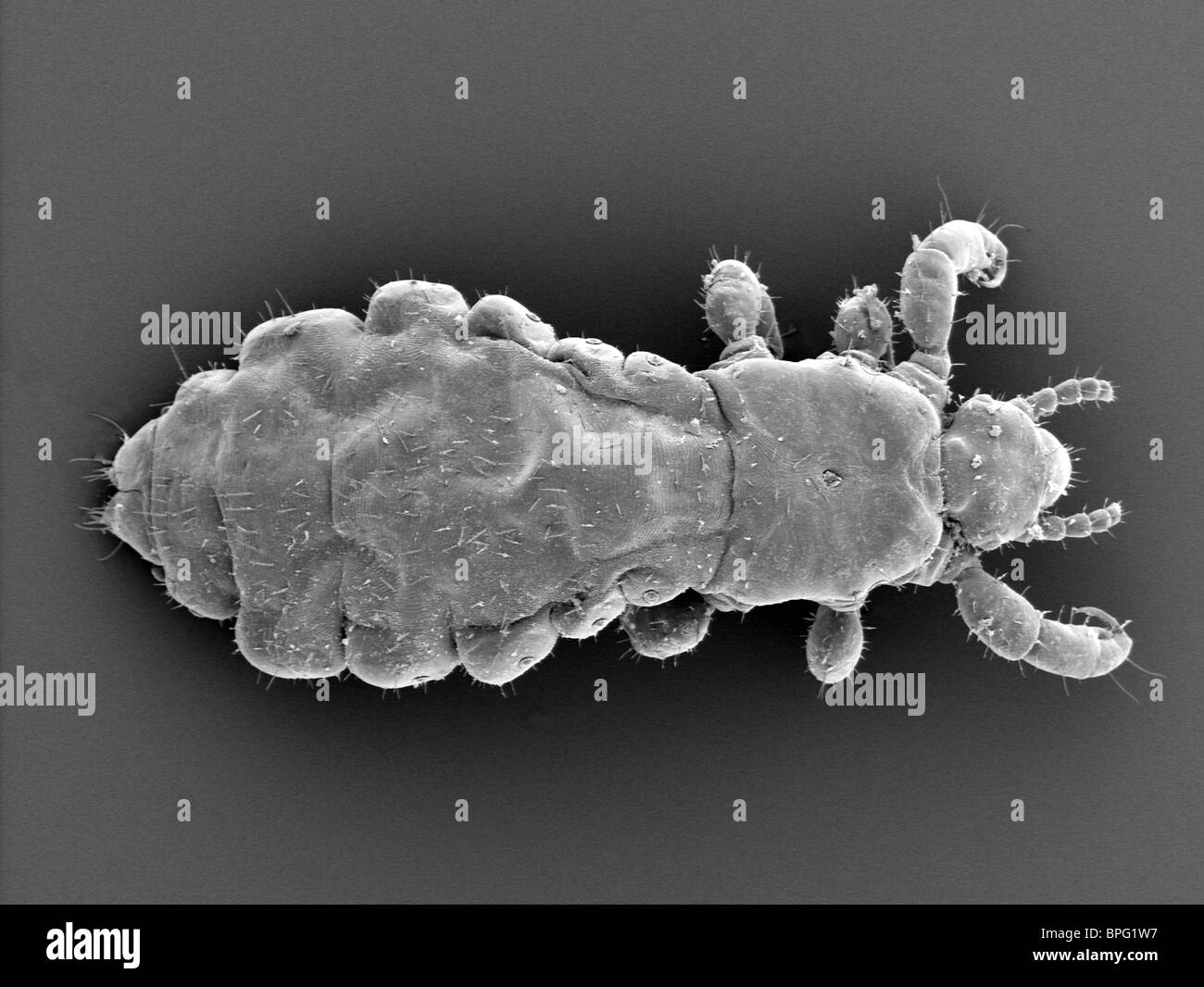 SEM - Pediculus humanus - Small sucking insect with large abdomen and legs with sharp claws for holding onto hair and fibres Stock Photo