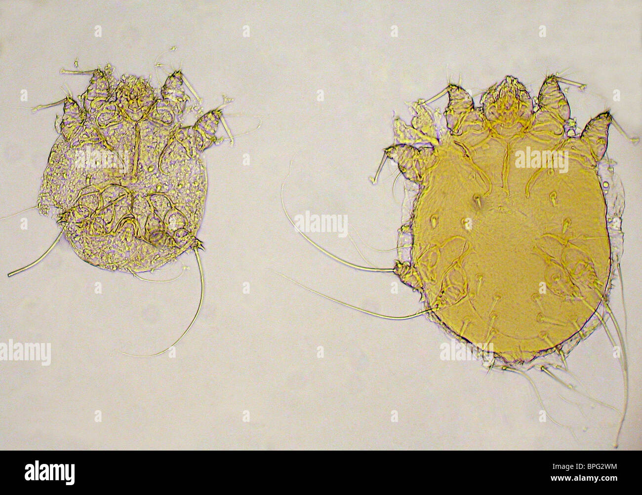 Caused by the mite Sarcoptes scabiei, variety hominis, it produces