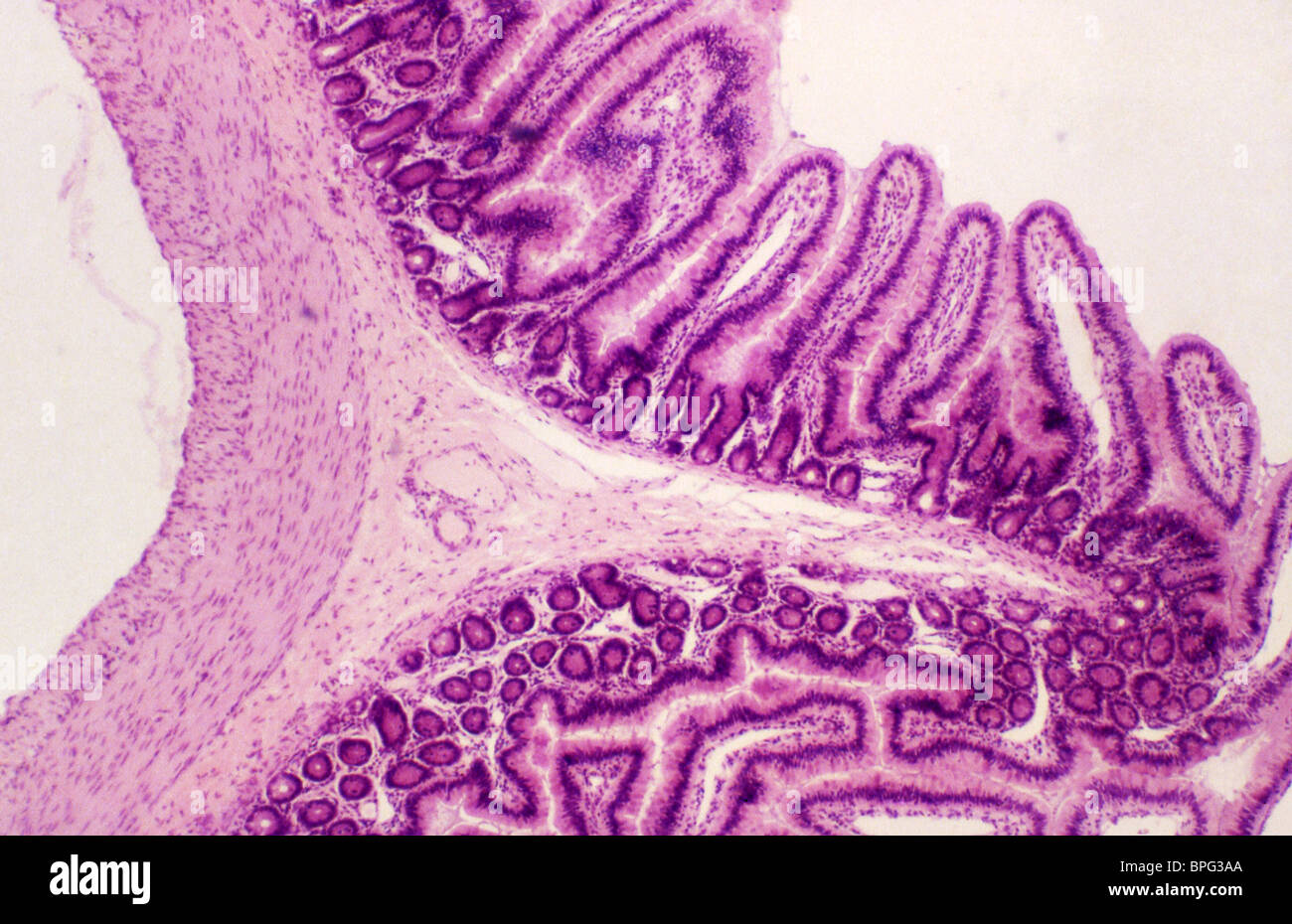 A light micrograph of a cross section of the jejunum clearly showing a