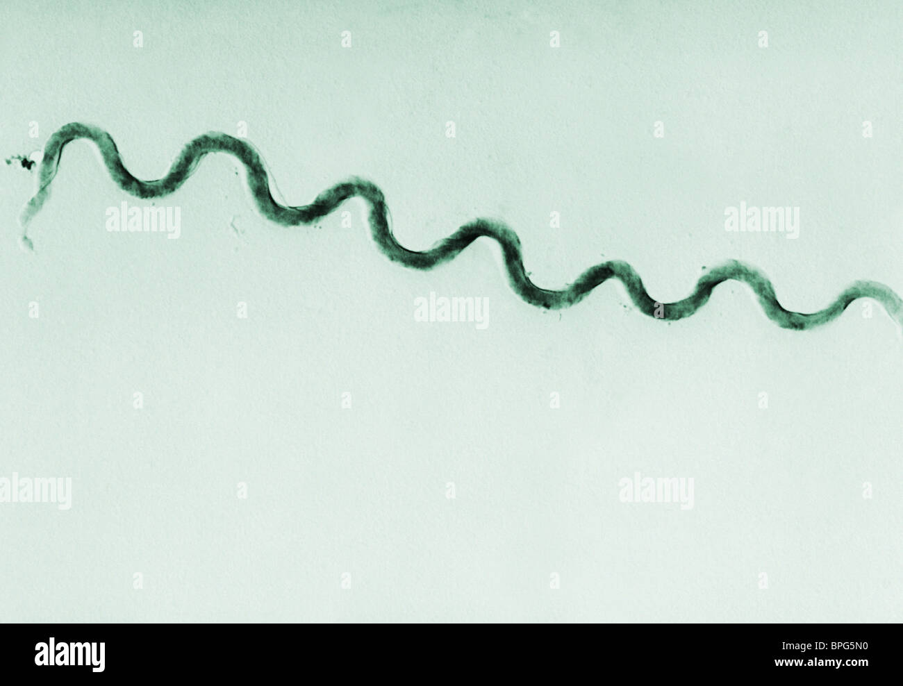 A photomicrograph of a Treponema pallidum bacterium Stock Photo