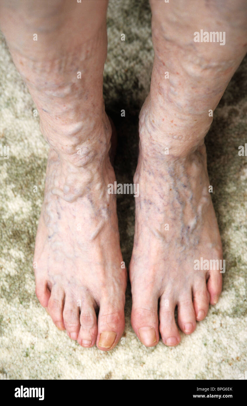 Veiny Feet Heels