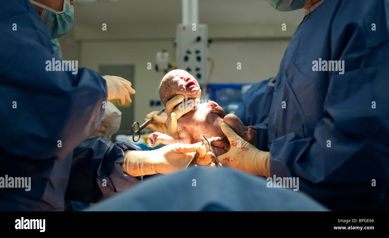 Baby being born via Caesarean Section coming out Stock Photo