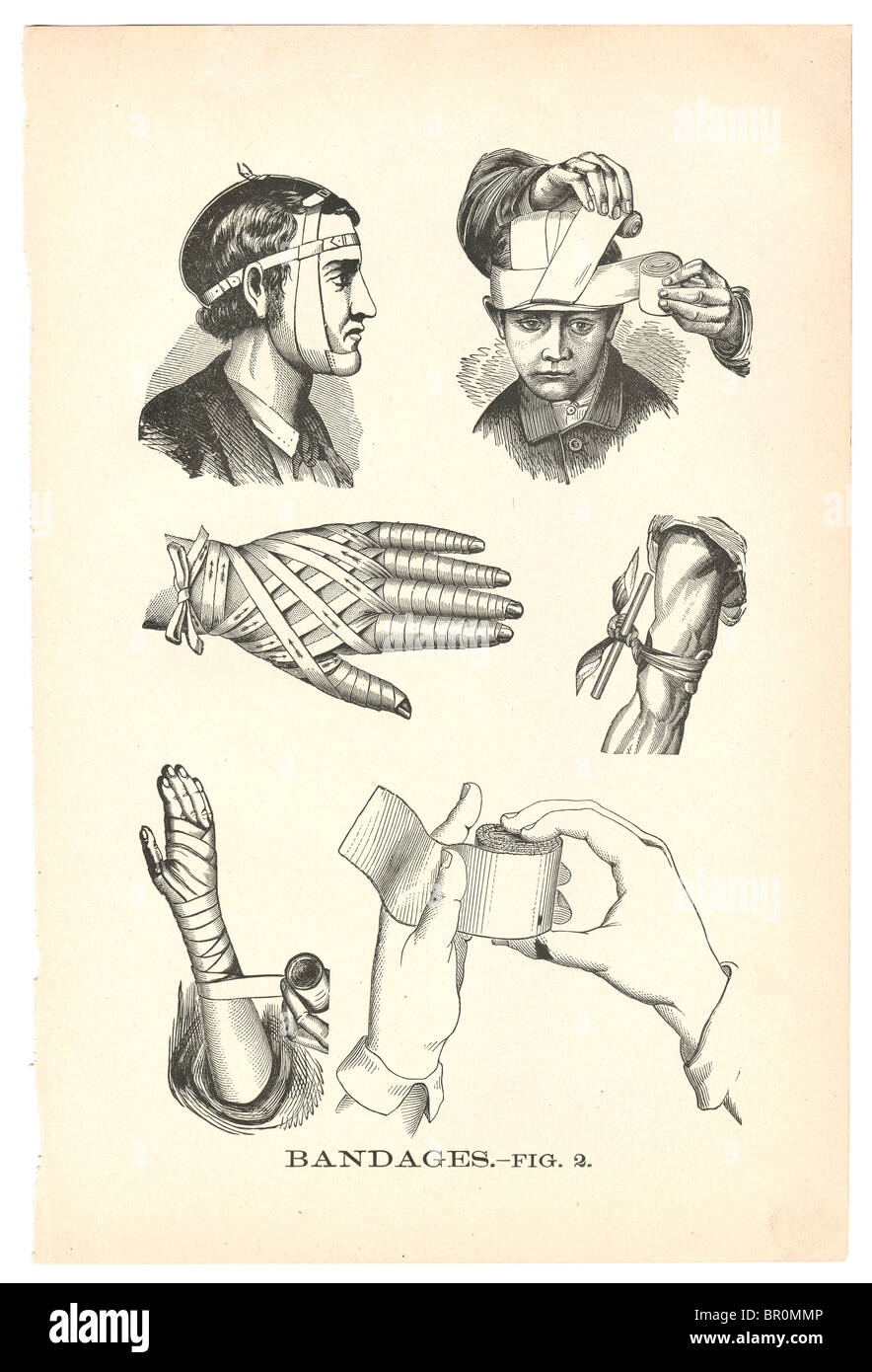A page of illustrations of bandaged injuries from a vintage book Stock Photo