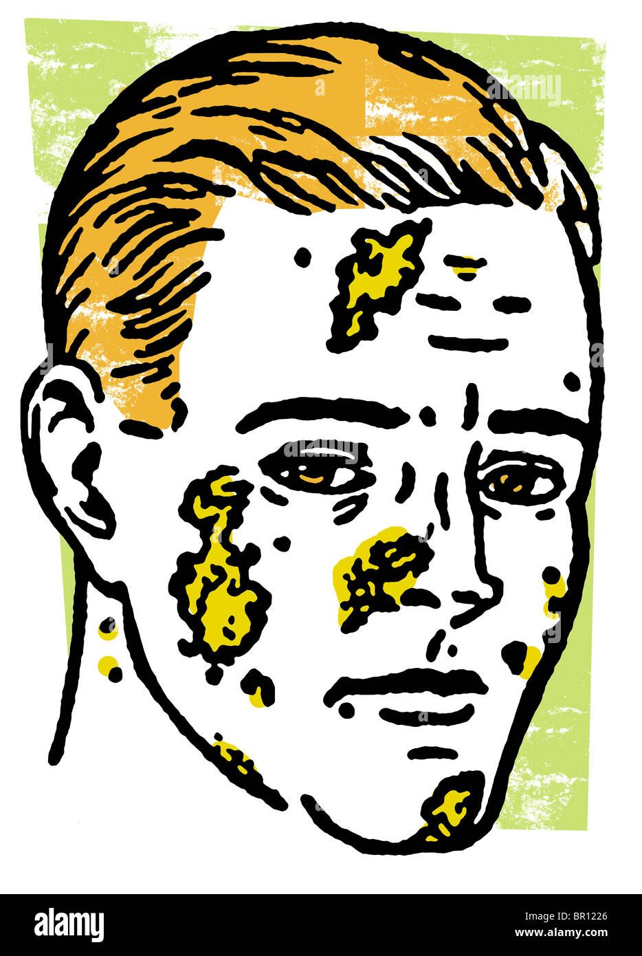 An illustration of an infected man Stock Photo