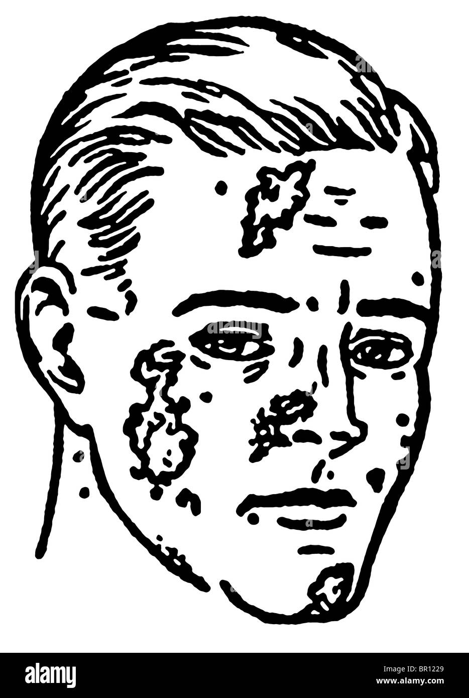 A black and white version of an illustration of an infected man Stock Photo