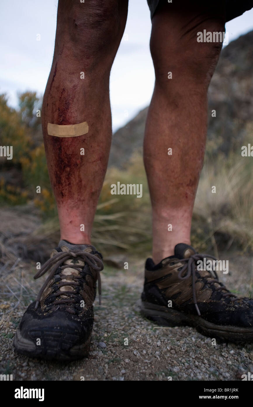 A hiker's shins are bruised and battered from hiking through dense brush and wild roses along the Lonesome Miner Trail in Califo Stock Photo