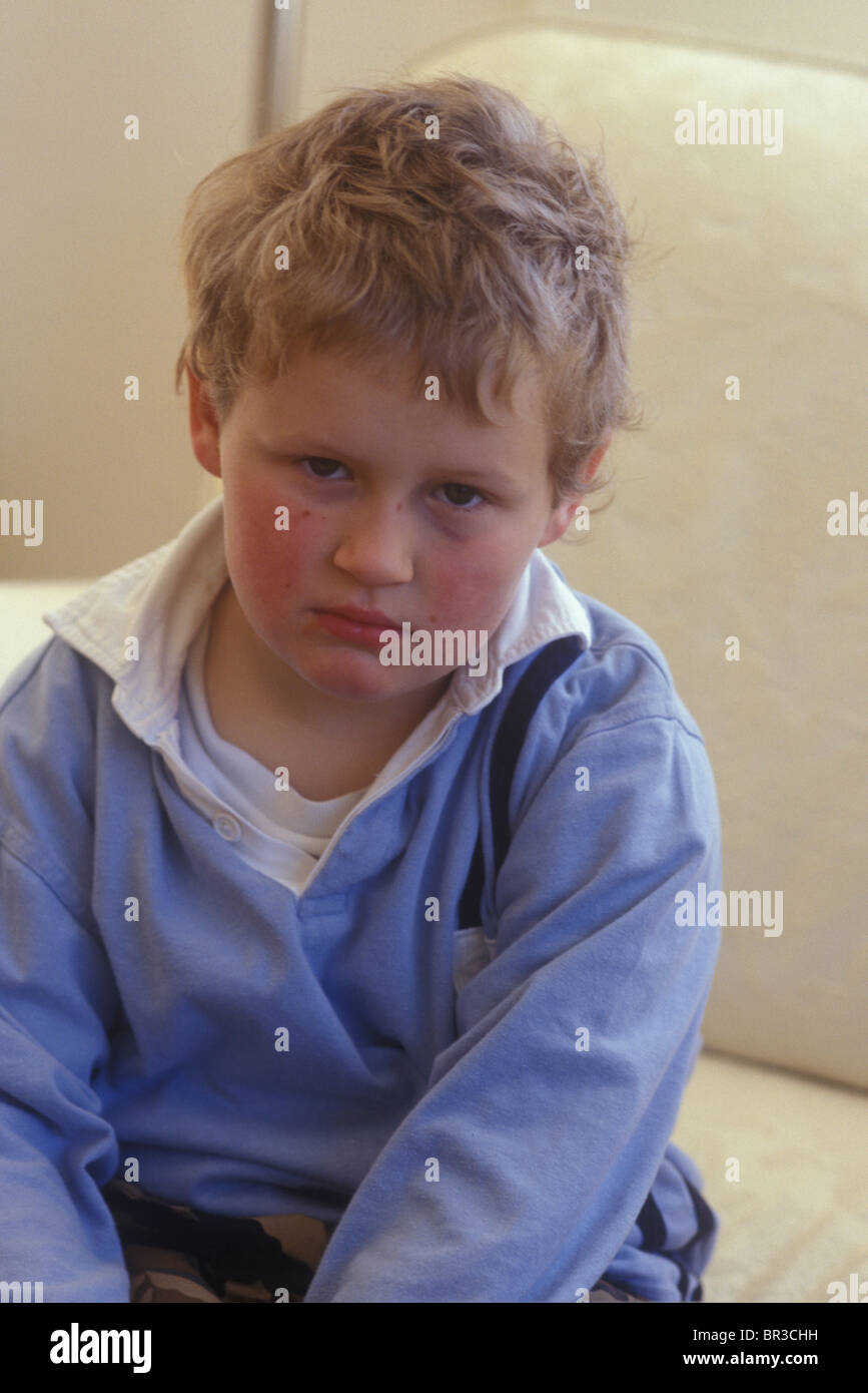 little boy looking sad and miserable with a black eye Stock Photo