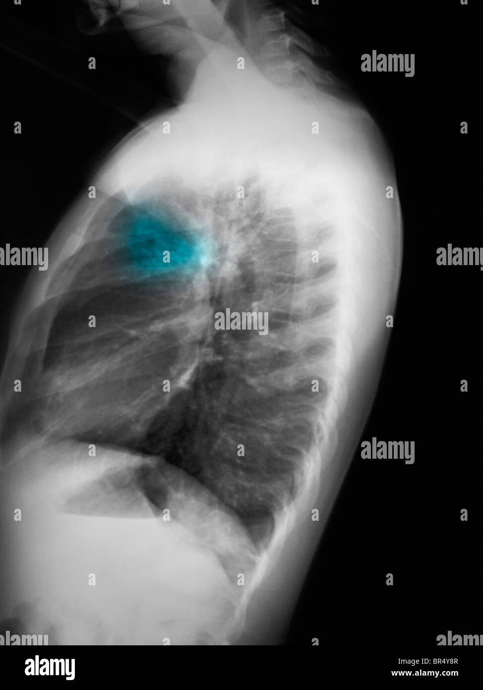 Chest anatomy hi-res stock photography and images - Alamy