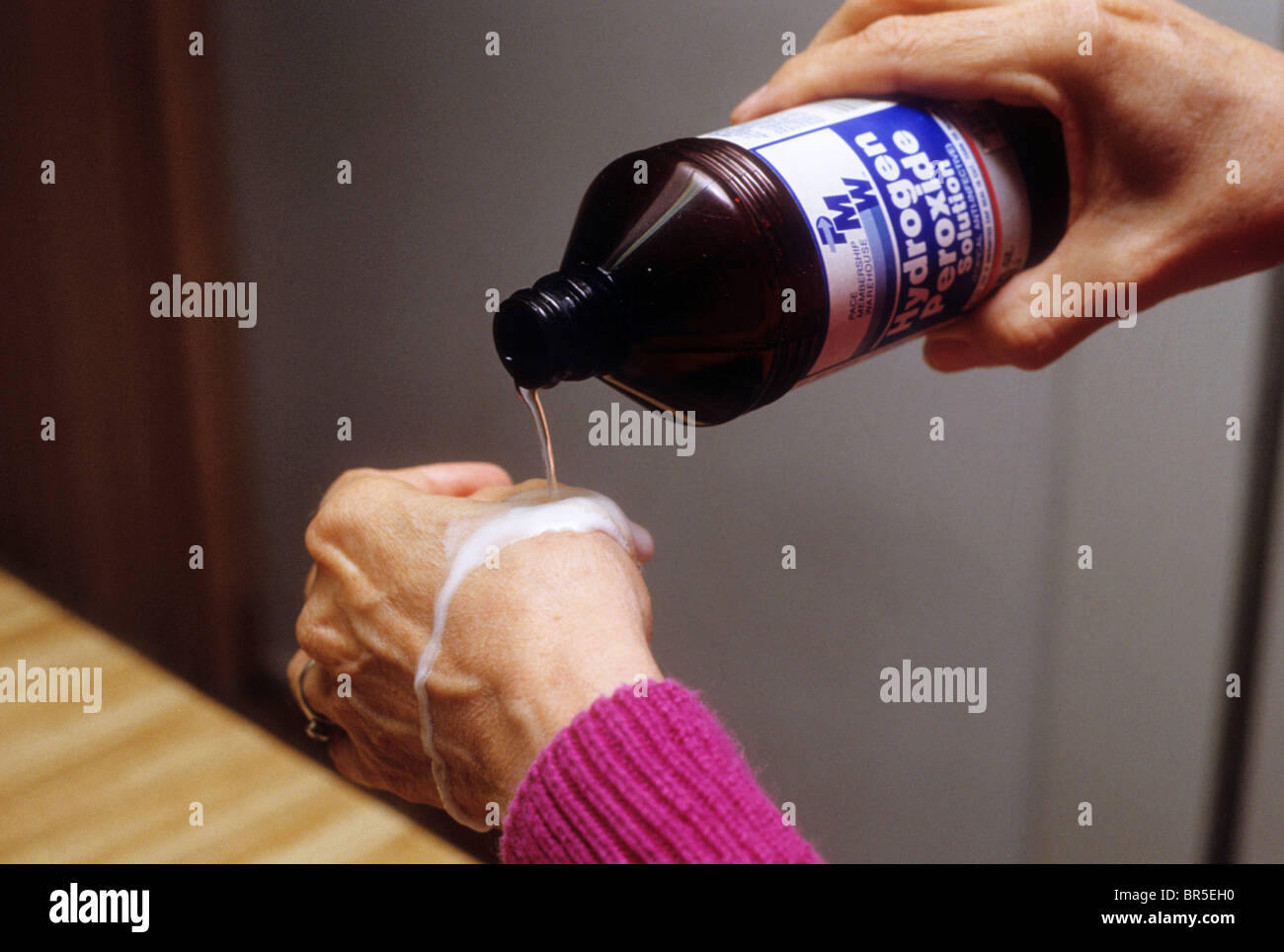 cut wound peroxide first aid treat cleanse infect prevent scratch