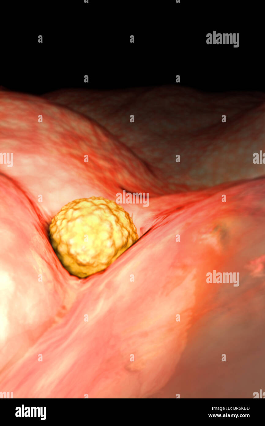 Week 4 in fetal development implantation hires stock photography and