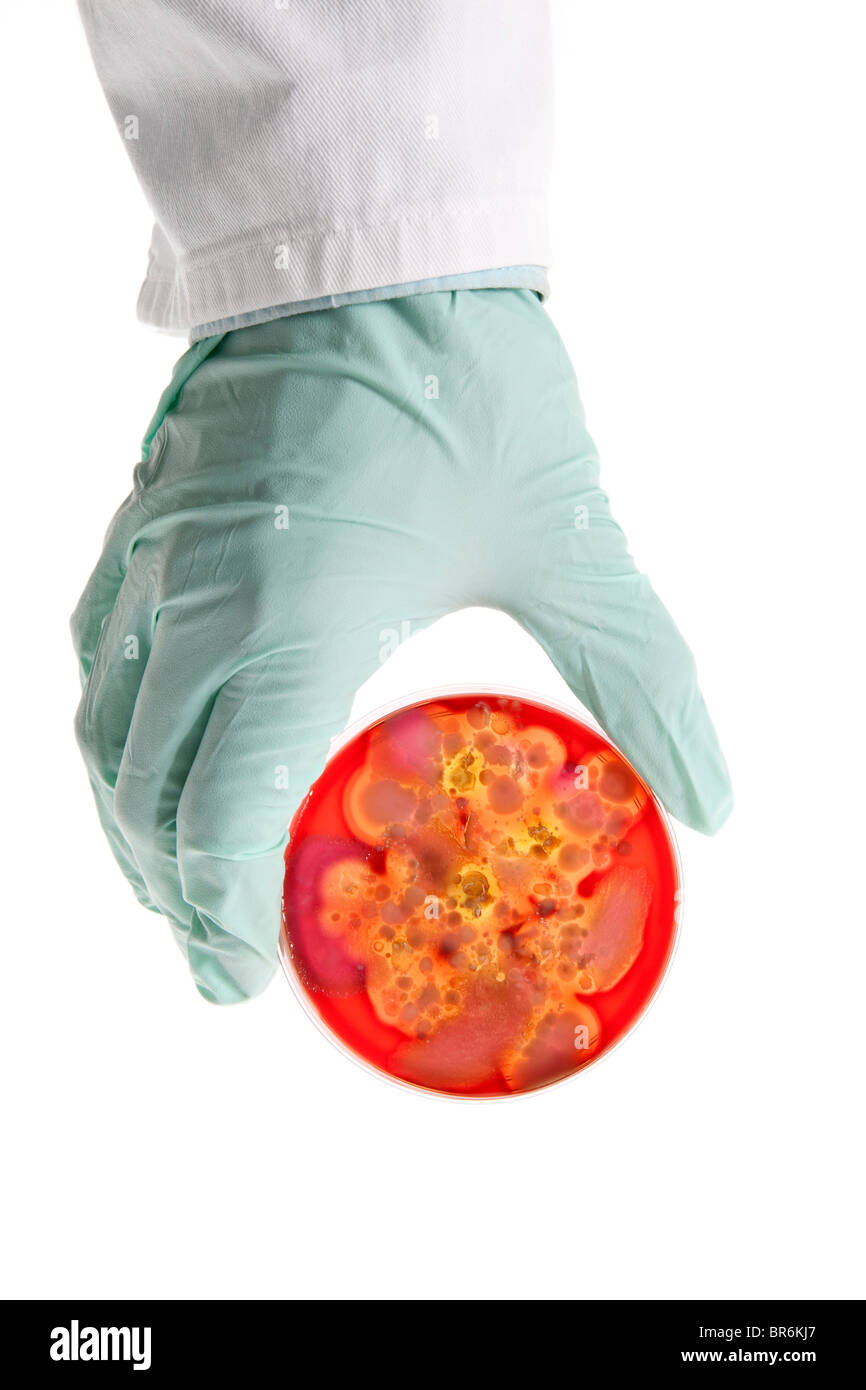 A lab technician holding a Petri dish with a bacteria culture growing in it, close-up of the hand Stock Photo