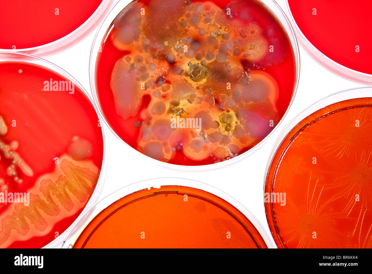 Petri dishes holding different stages of bacteria cultures Stock Photo