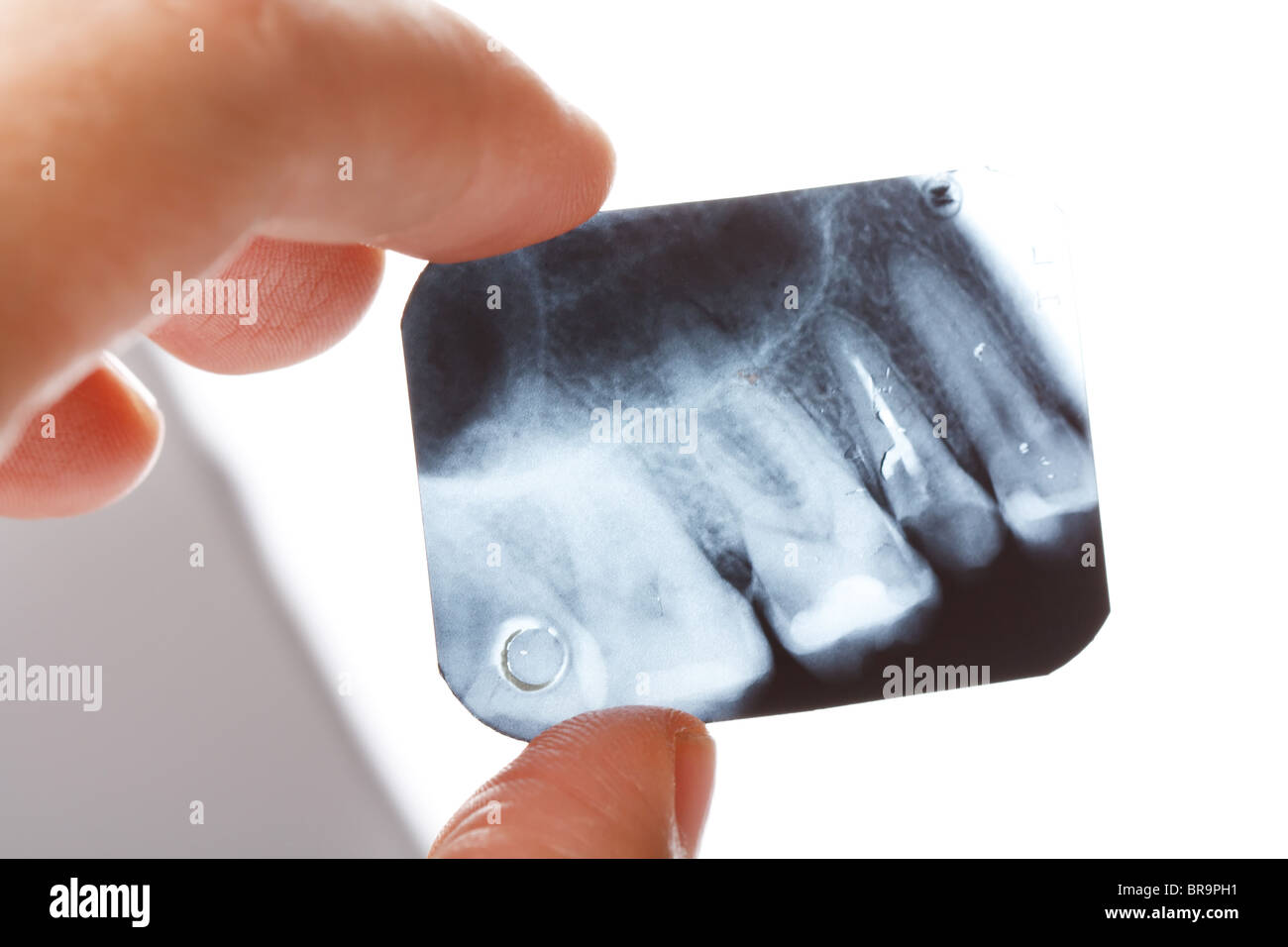 Hand holding molar hi-res stock photography and images - Alamy