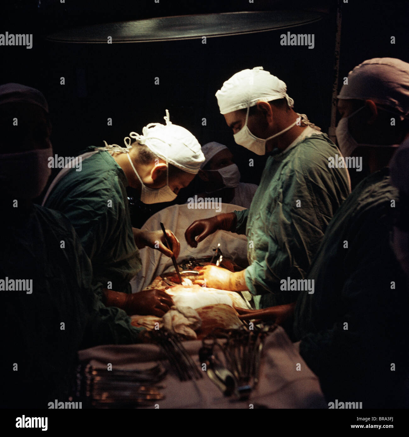 1960s DOCTORS PERFORMING ABDOMINAL SURGERY IN OPERATING ROOM Stock Photo