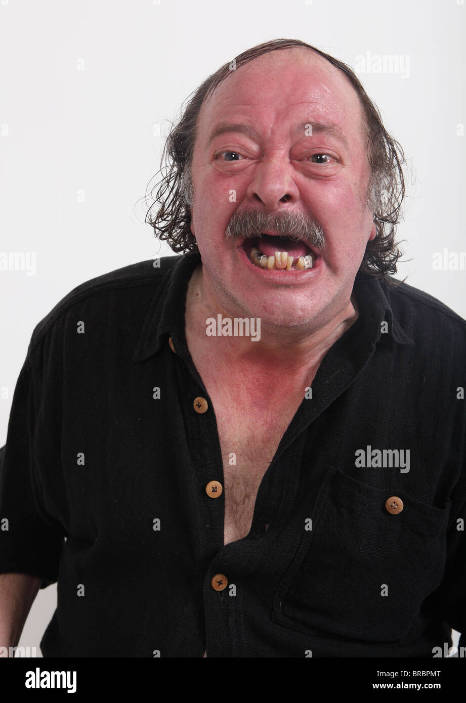 Homeless caucasian fat character portrait with bad teeth, looking aggressively into the camera Stock Photo