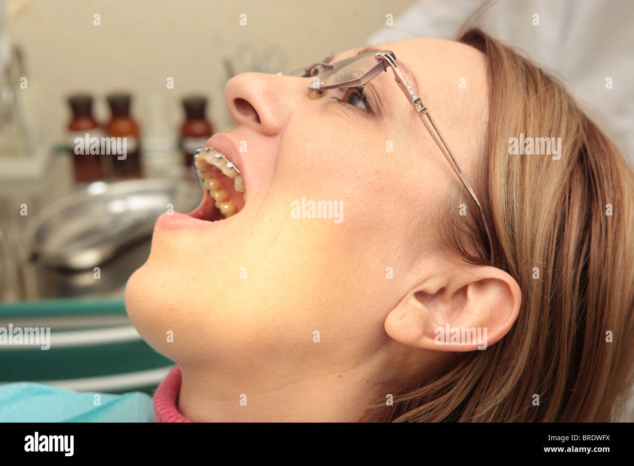 Woman making pain expression while removing braces at the dentist's