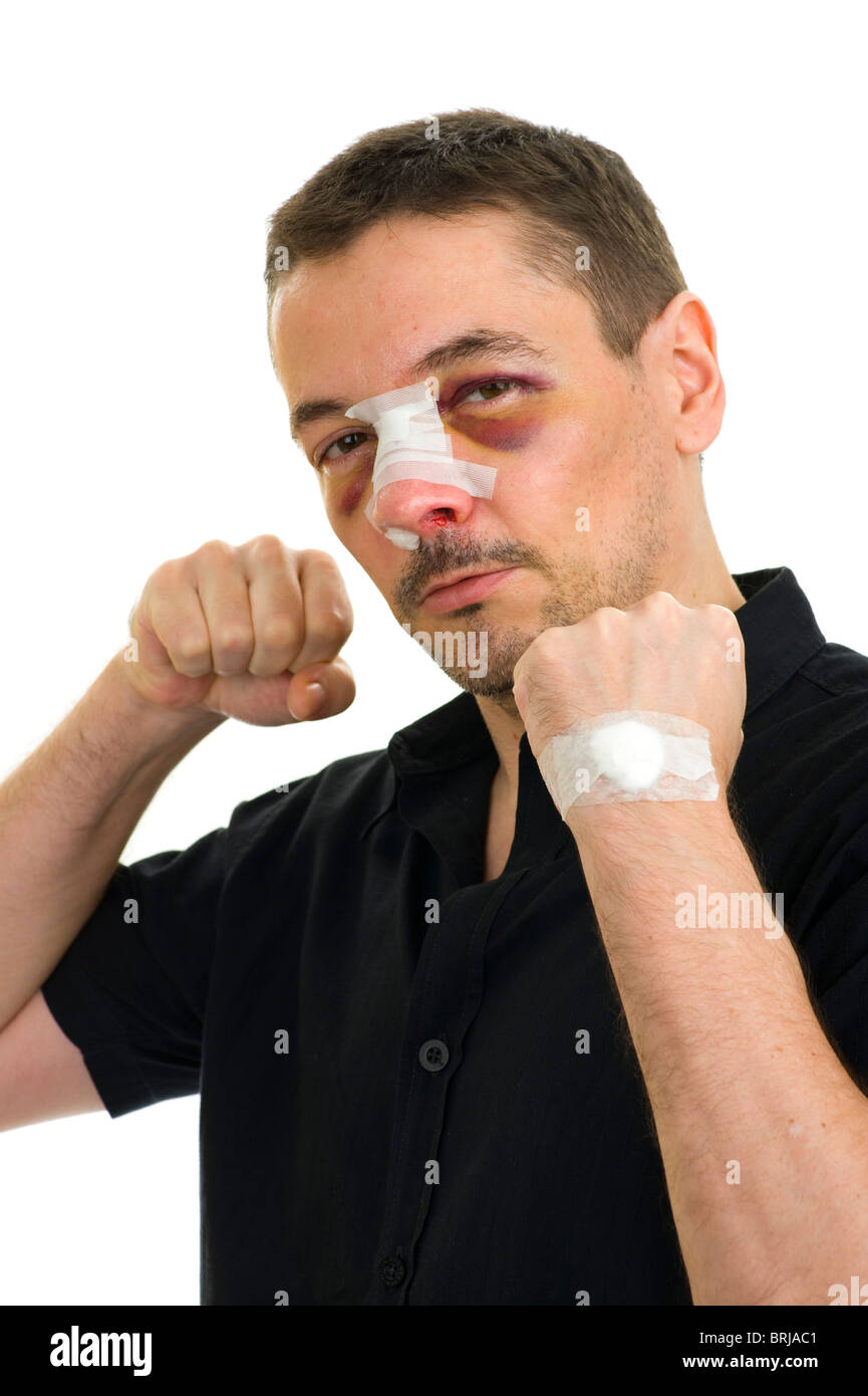 Broken Nose Stock Photos & Broken Nose Stock Images - Alamy