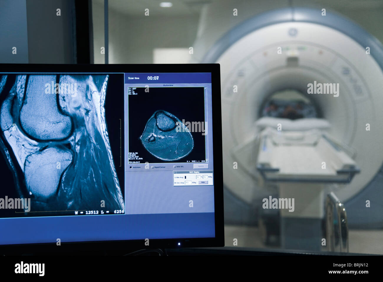 MRI scan result on computer monitor Stock Photo