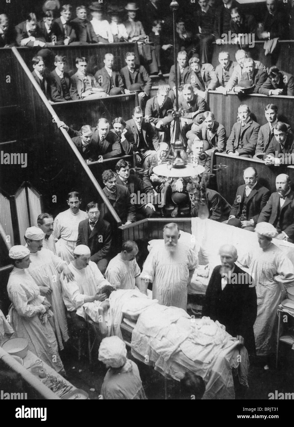 VINCENZ CZERNY (1842-1916) Austrian-German surgeon (arm on table) performing an operation for renal carcinoma in 1887 Stock Photo