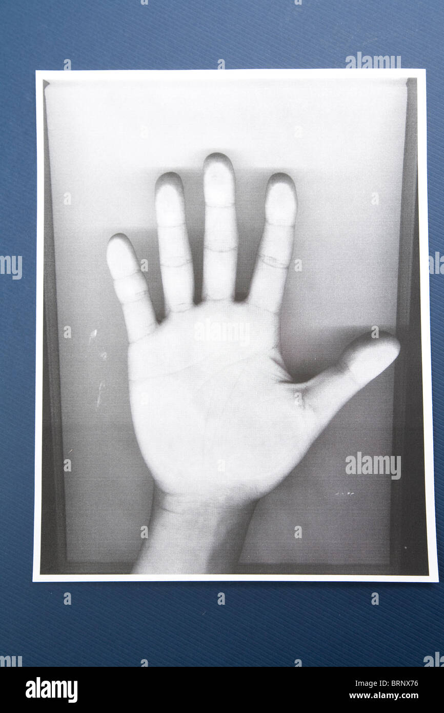Black and white Photocopy of hand Stock Photo Alamy
