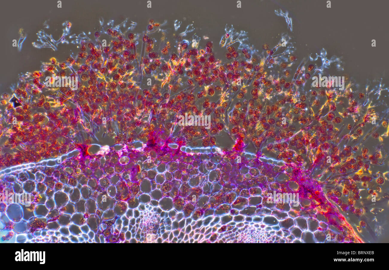 Darkfield photomicrograph, Peronospora fungal spores in TS of crucifer sp, conidia Stock Photo