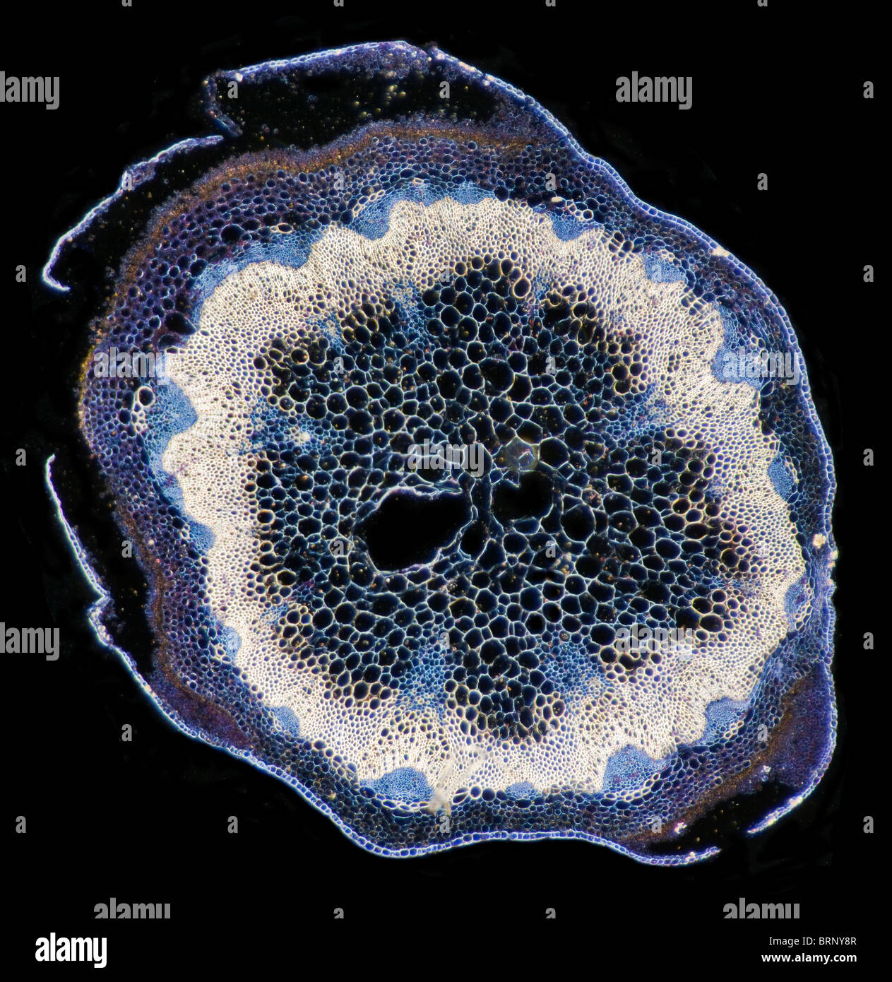 Darkfield photomicrograph of Cystopus candidus, fungus growing on root of Sheperds Purse Stock Photo