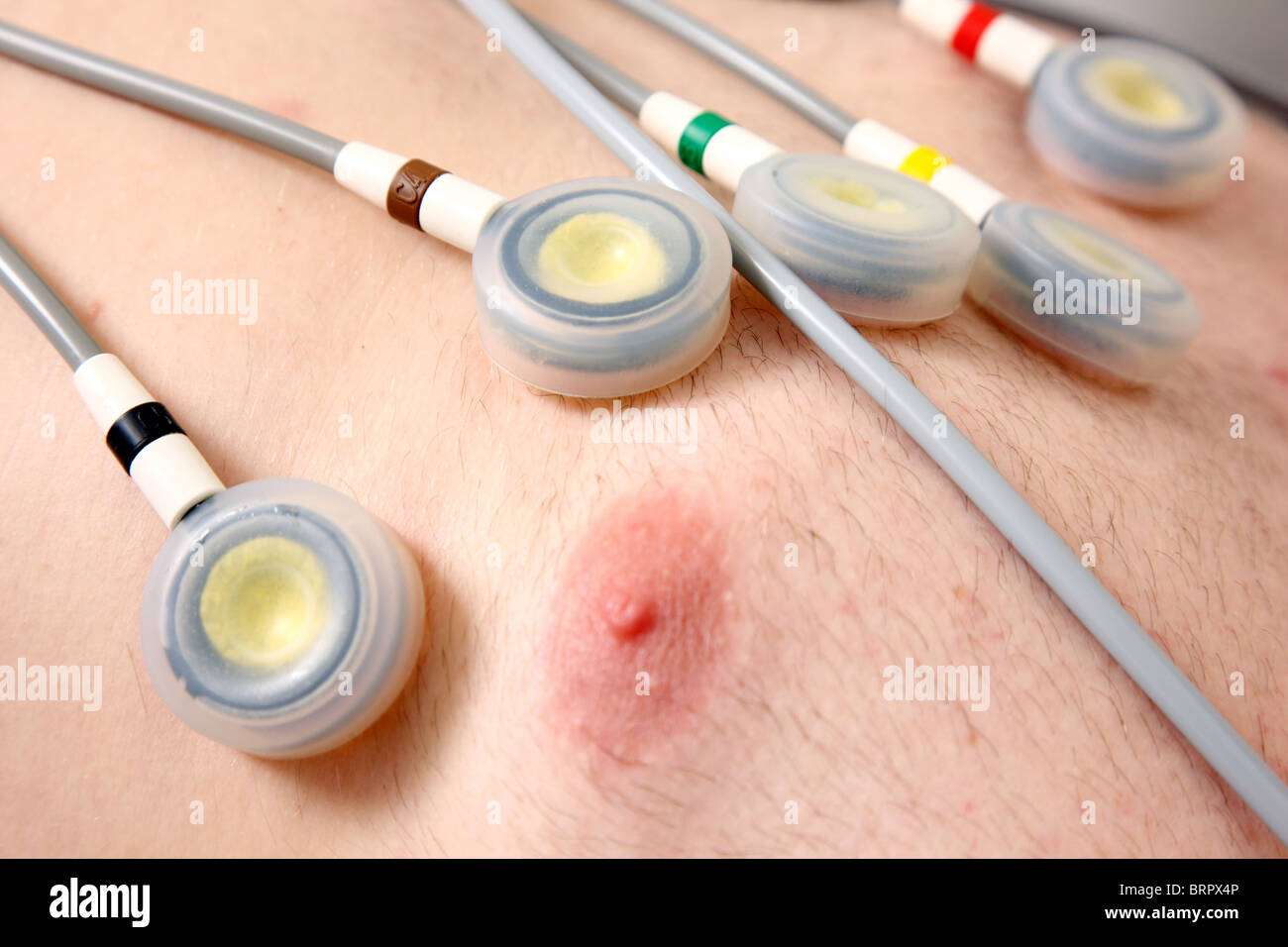 Doctor's surgery,  patient at an ECG, Electro cardiograph, test, recording,  preventive check up. Stock Photo