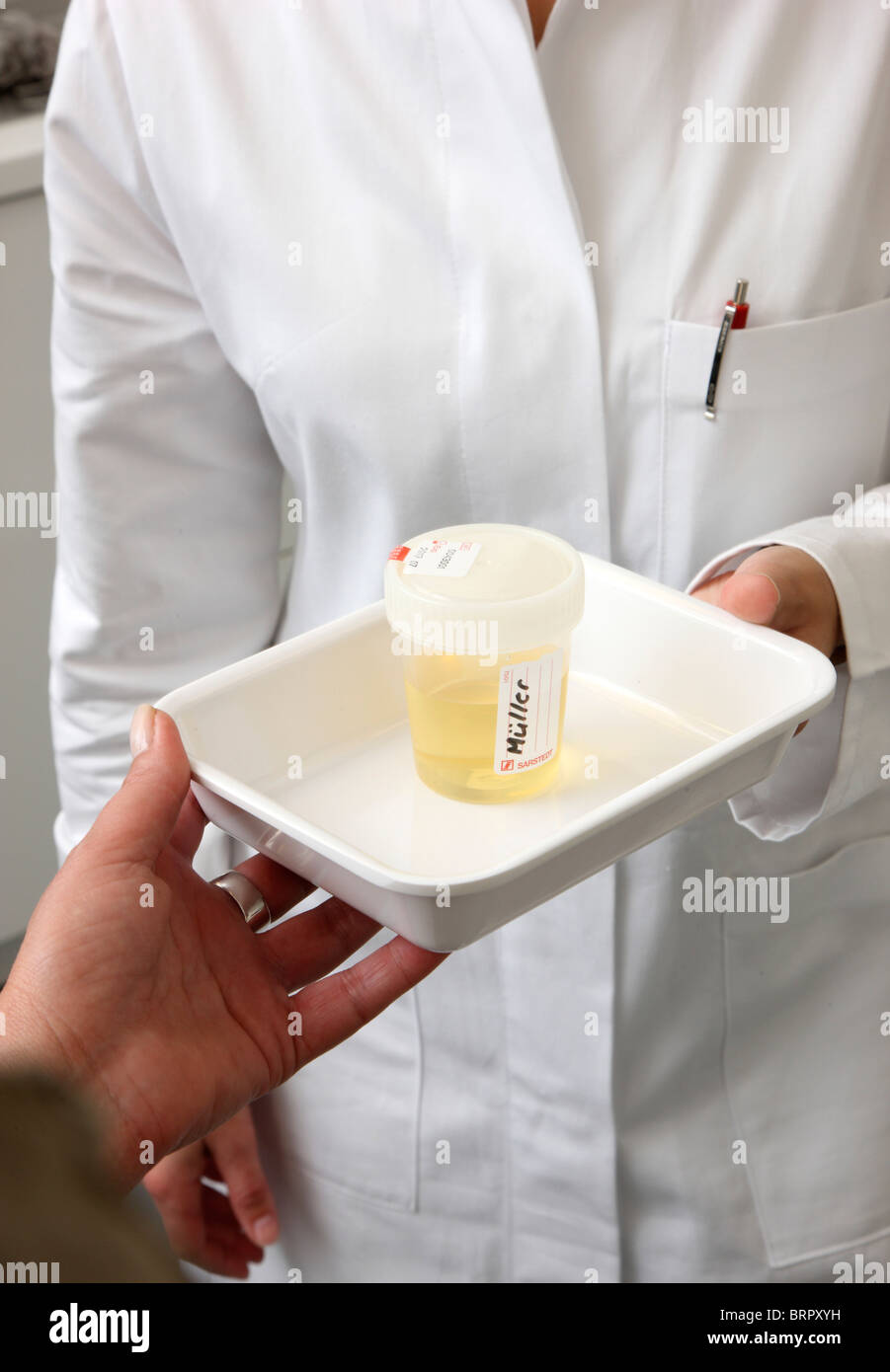 Doctors surgery, medical practice. Urine sample for an analyze in a