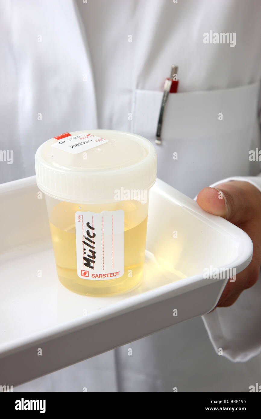 Doctors surgery, medical practice. Urine sample for an analyze in a
