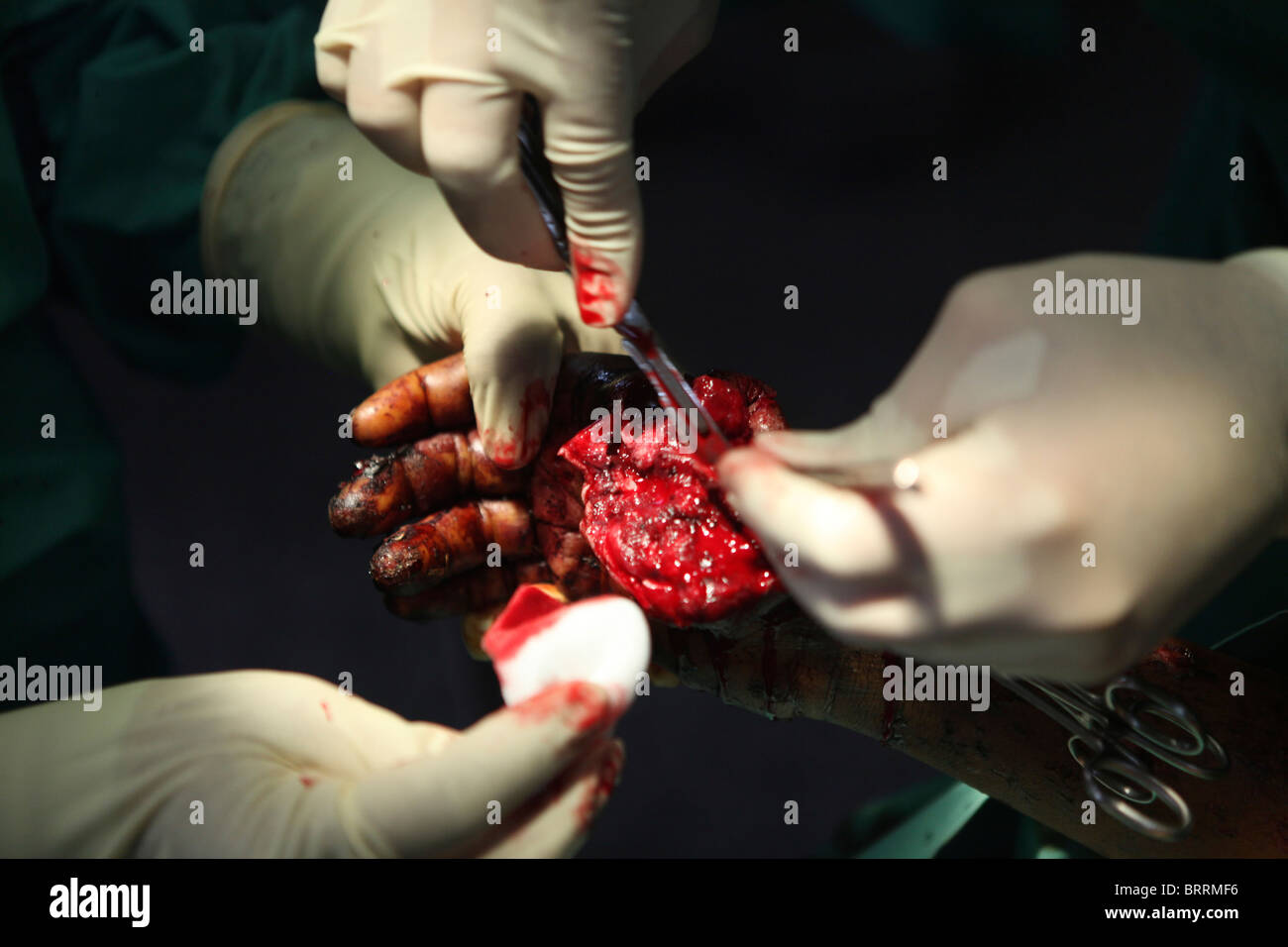 surgical theatre in Boost hopsital, Afghanistan Stock Photo