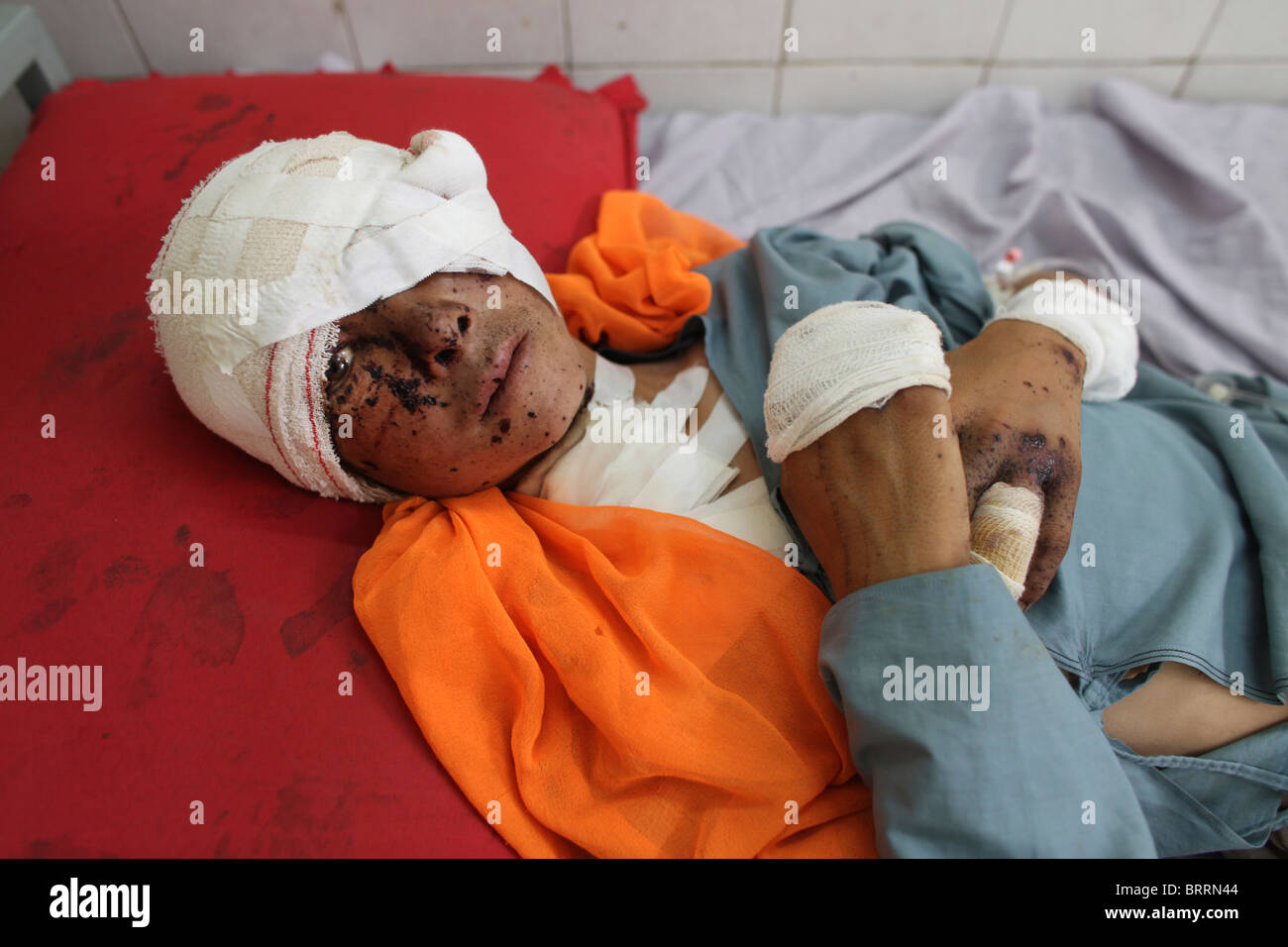 victims of a IED attack in Afghanistan Stock Photo
