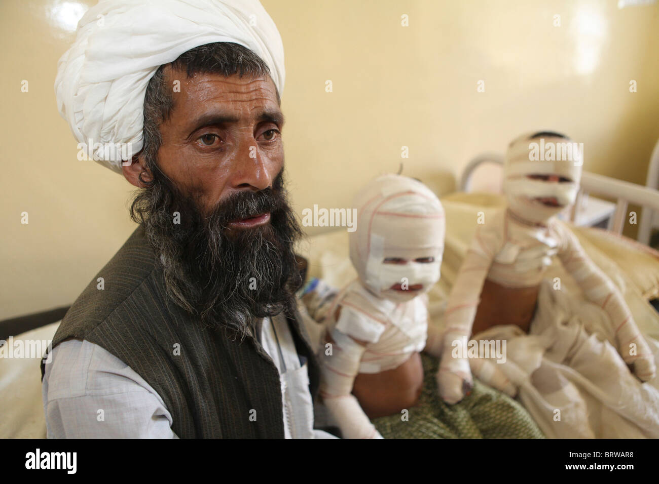 burn victims of a IED attack in Afghanistan Stock Photo