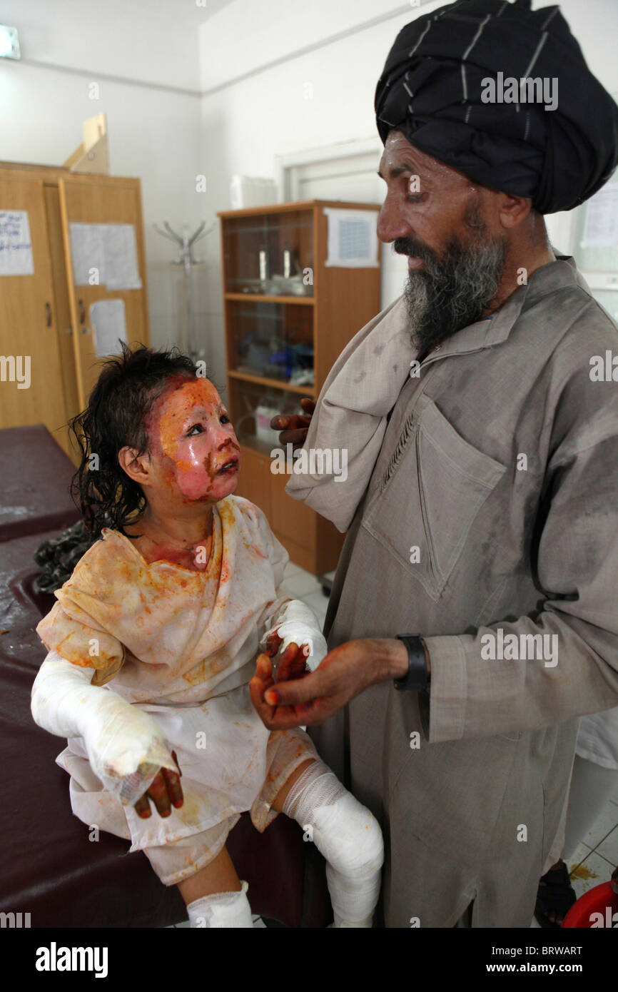 burn victims of a IED attack in Afghanistan Stock Photo