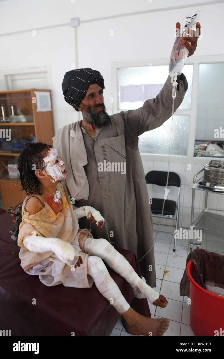 burn victims of a IED attack in Afghanistan Stock Photo