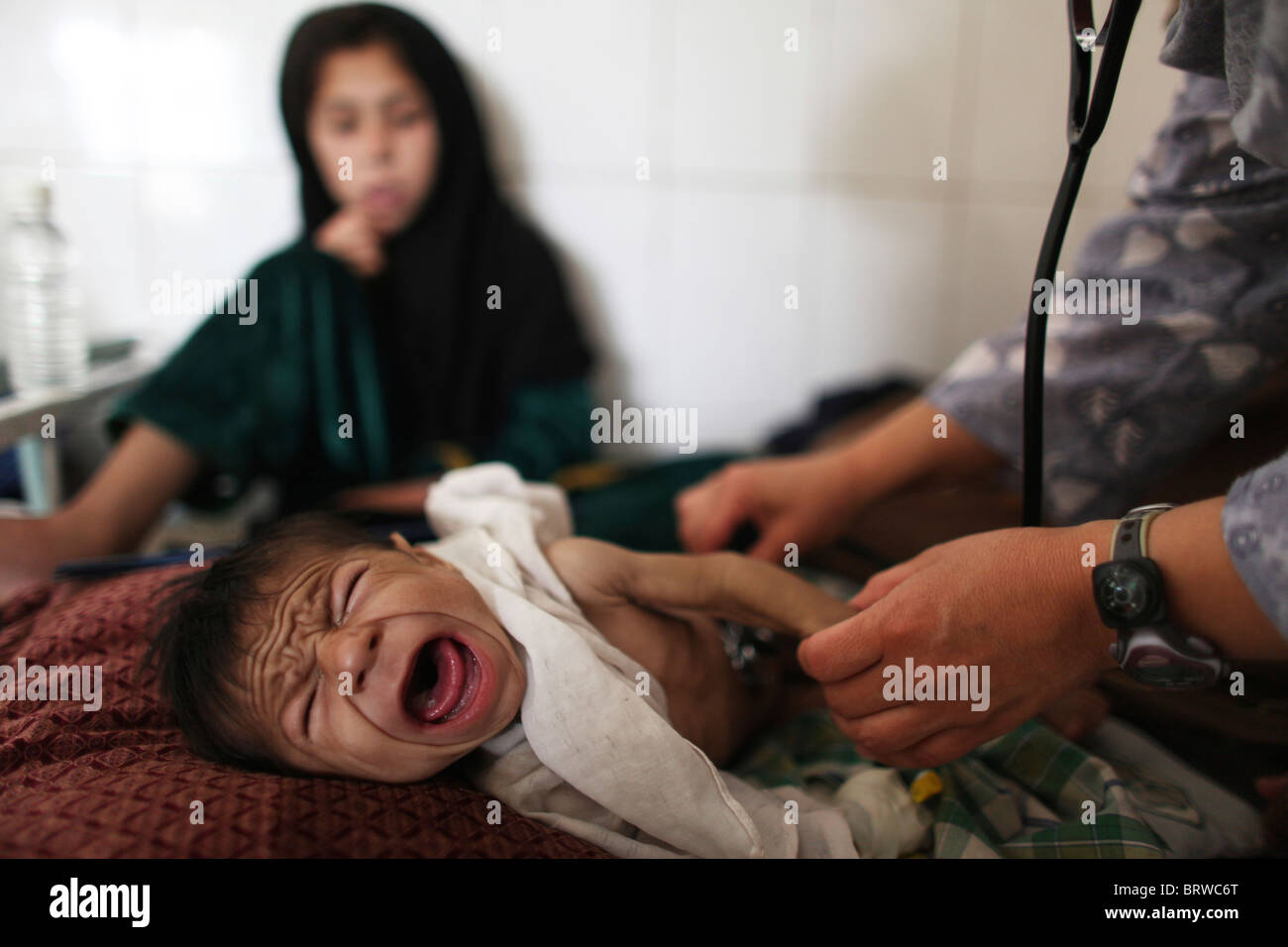 malnutrition among patients in a pediatric ward of a hospital Afghan Stock Photo