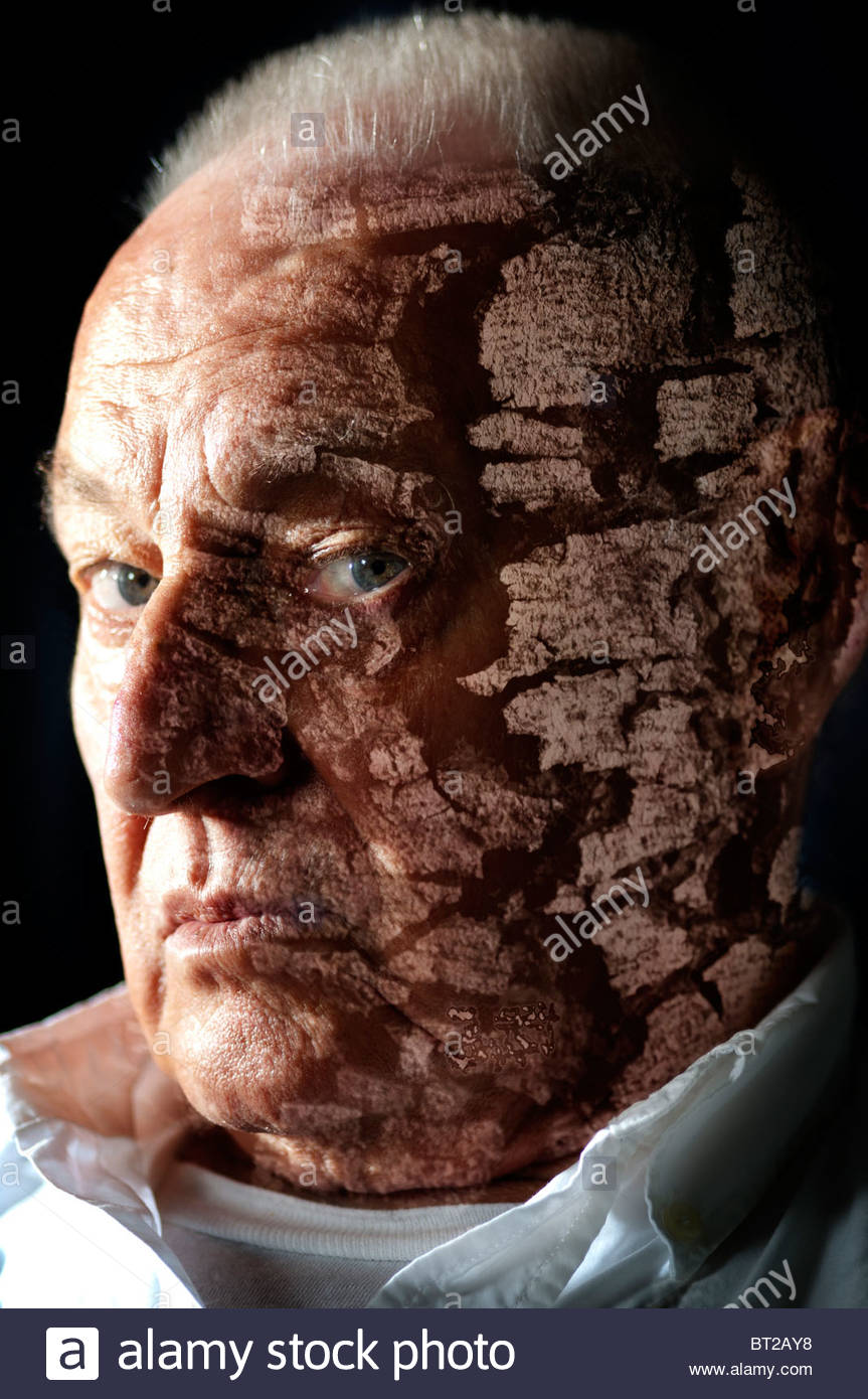 Bad Skin Problems