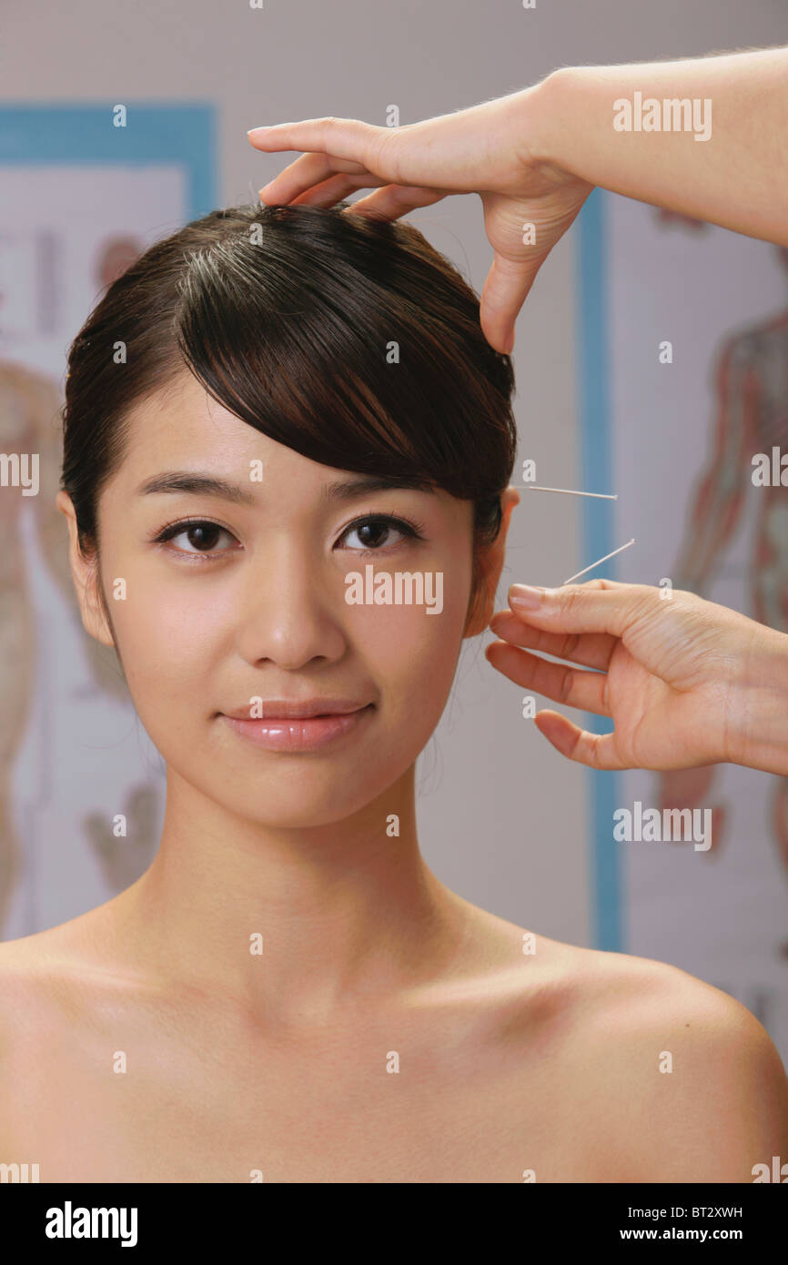 Doctor putting acupuncture needles on womans ear hires stock