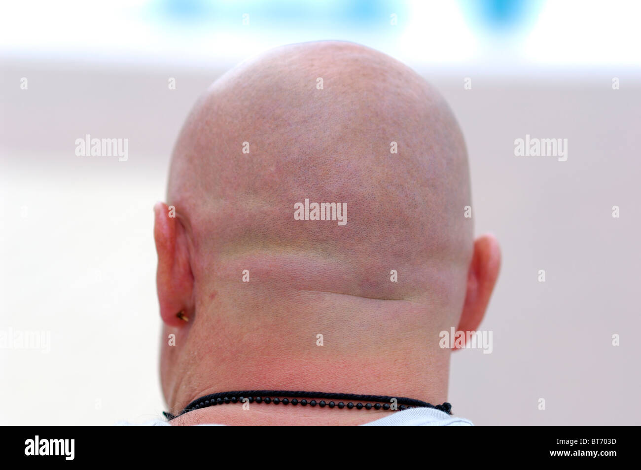 Bald-headed male Person Stock Photo