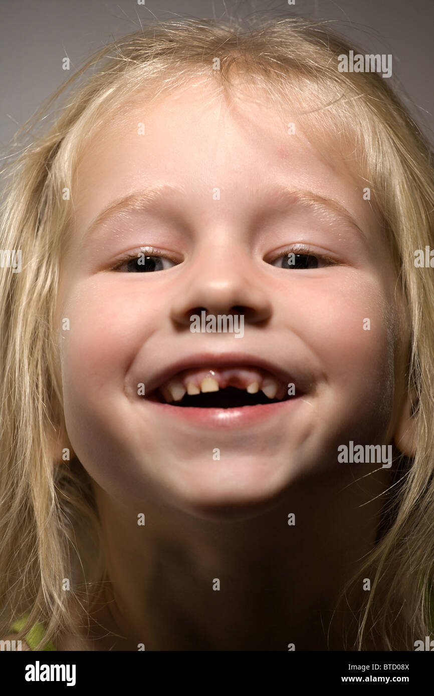 funny smiling little girl without one front tooth Stock Photo - Alamy