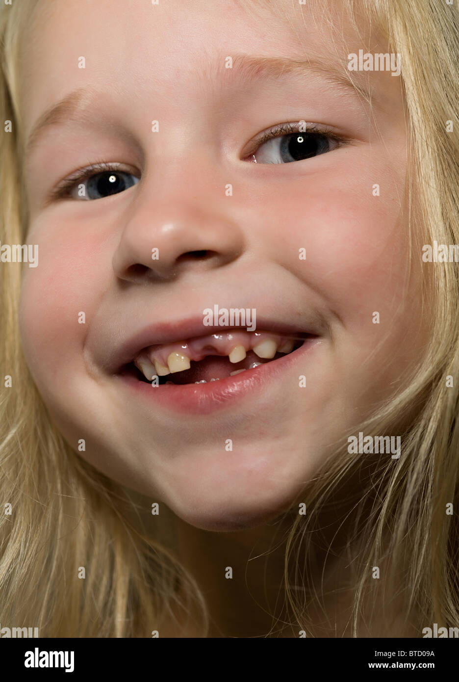 funny smiling little girl without one front tooth Stock Photo Alamy