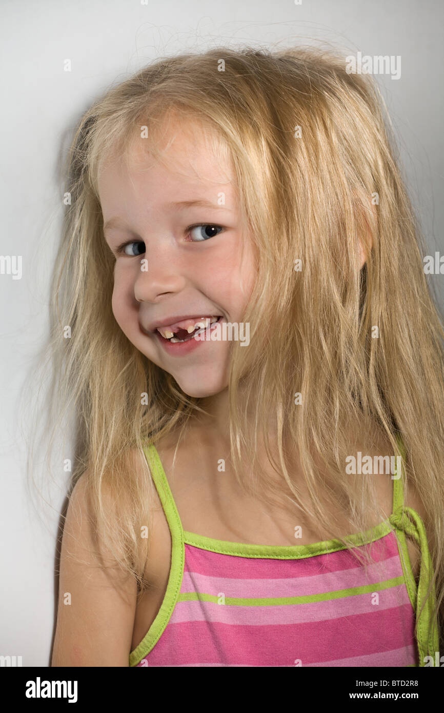 funny smiling little girl without one front tooth Stock Photo Alamy