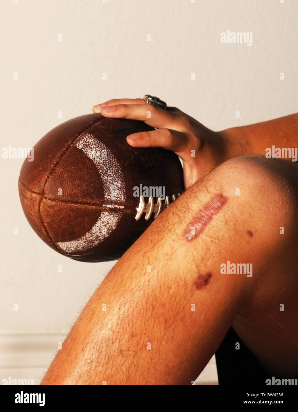 ACL football injury Stock Photo